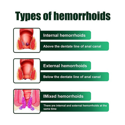 Crema para hemorroides